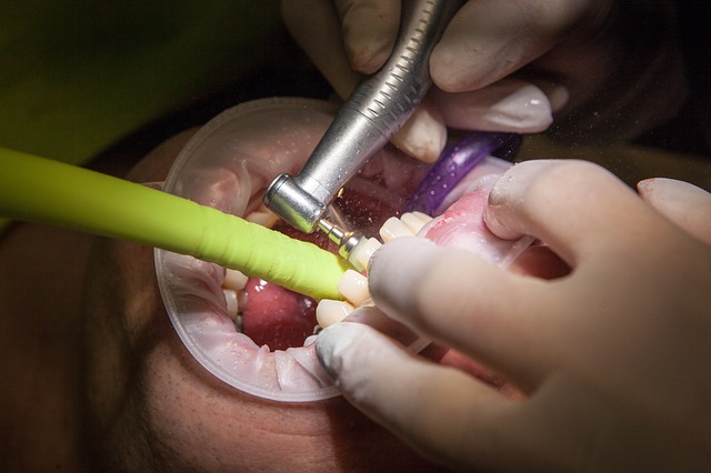 zadośćuczynienie za błąd stomatologa